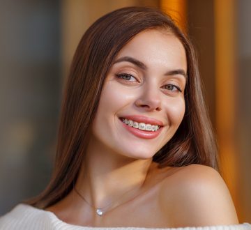 Everything You Need to Know Concerning Traditional Braces